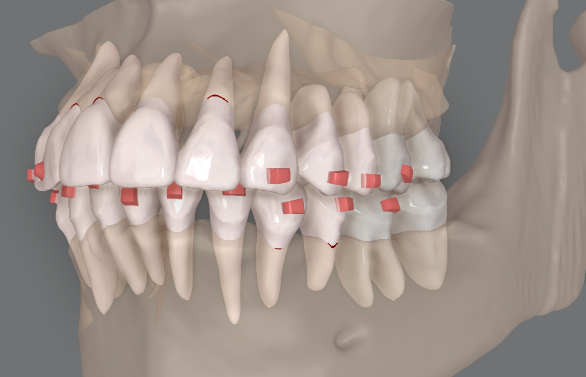 仕上げが決め手 2